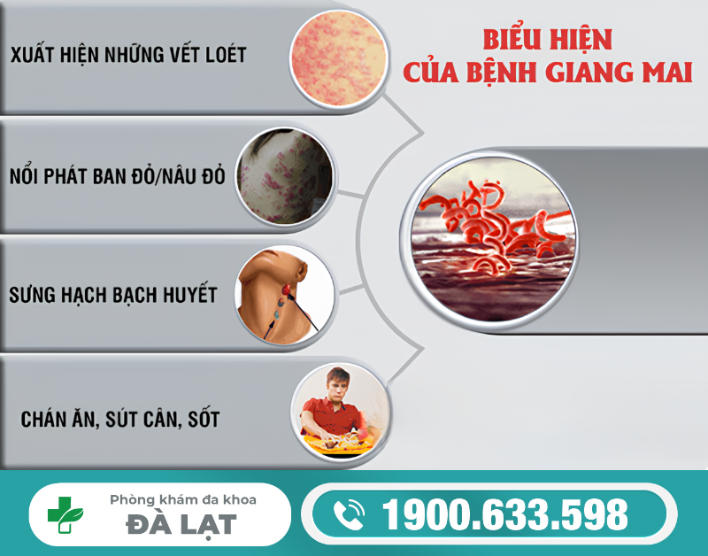 Hình ảnh minh họa